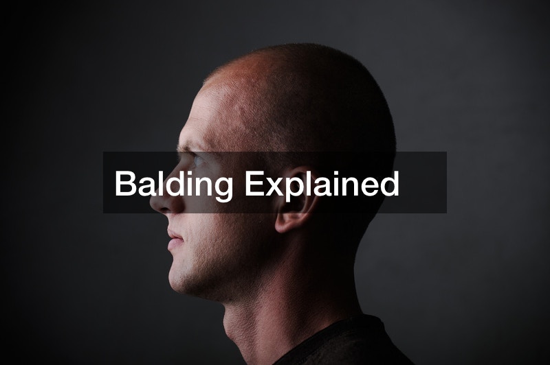 Balding Explained
